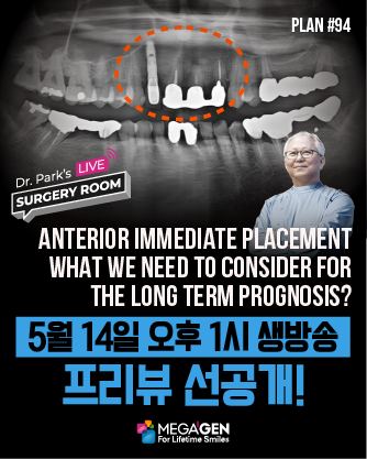 배너