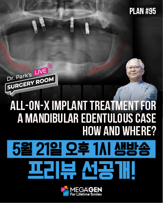 배너