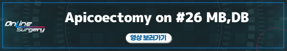 배너