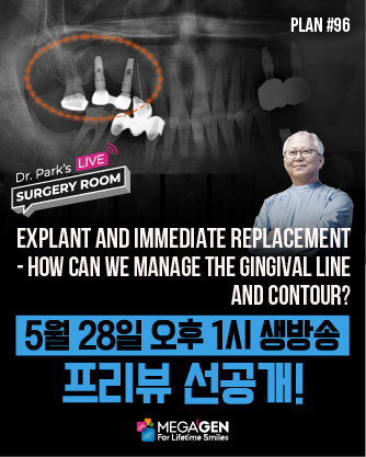배너