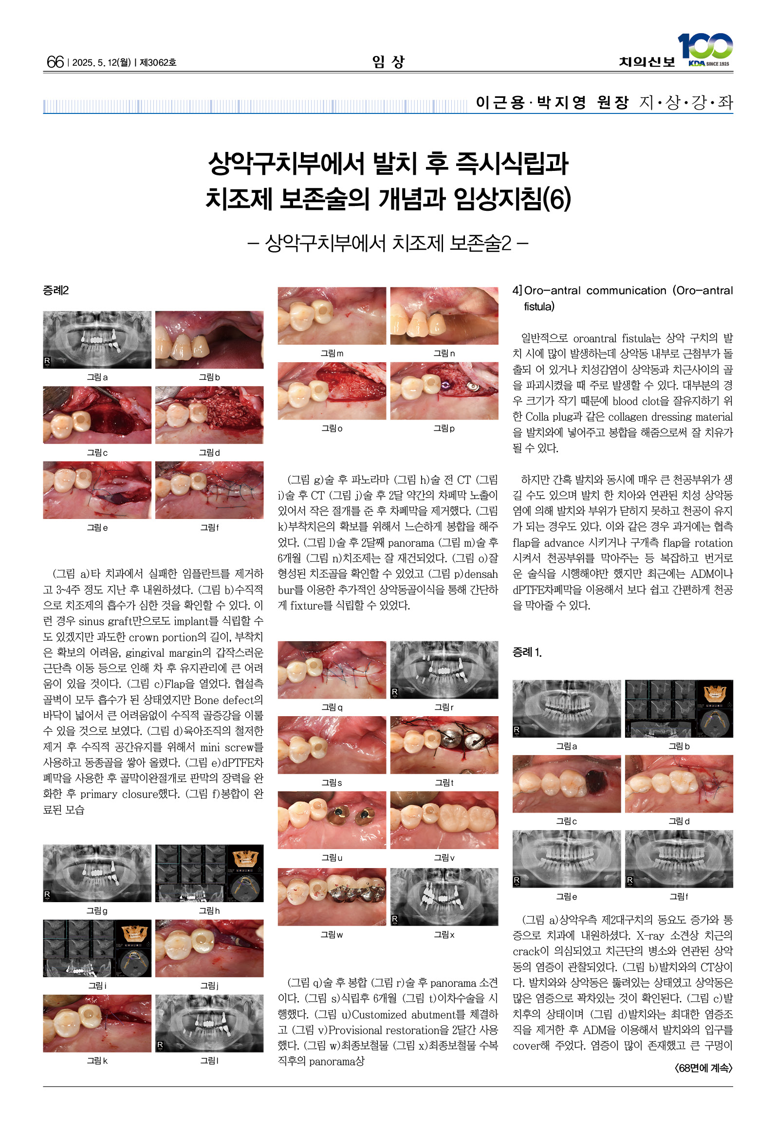 66_CG_0507_임상
