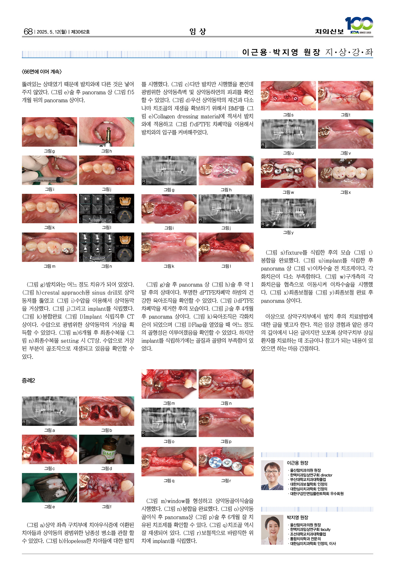 68_CG_0507_임상