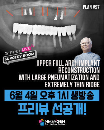 배너