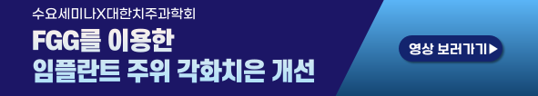배너