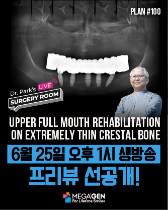 배너