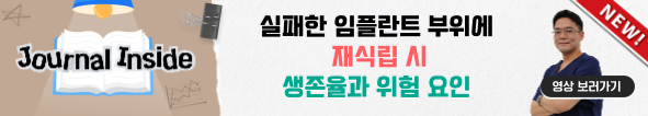 배너
