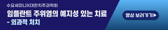 배너
