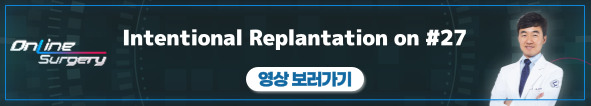 배너