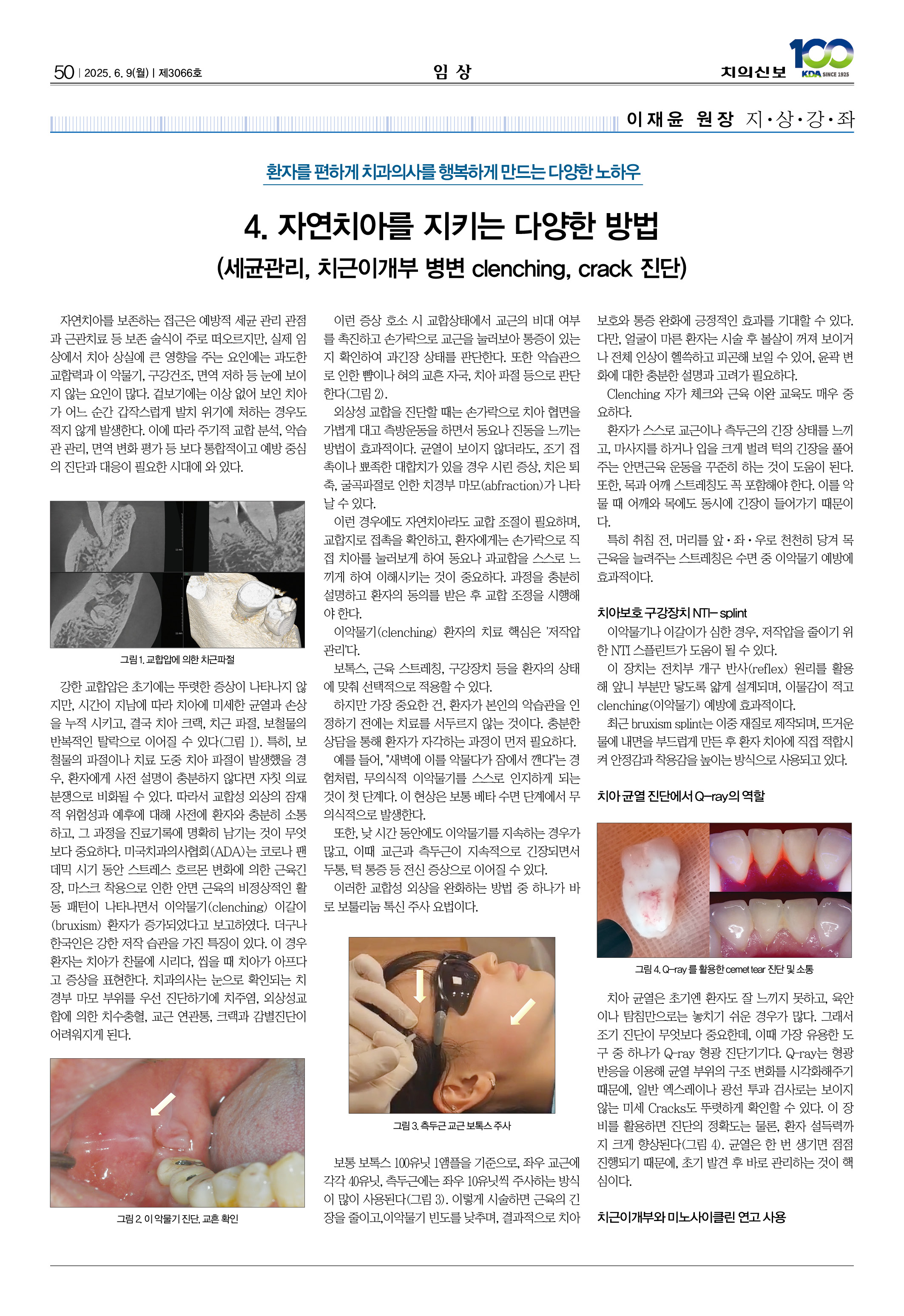 50_CG_0604_임상