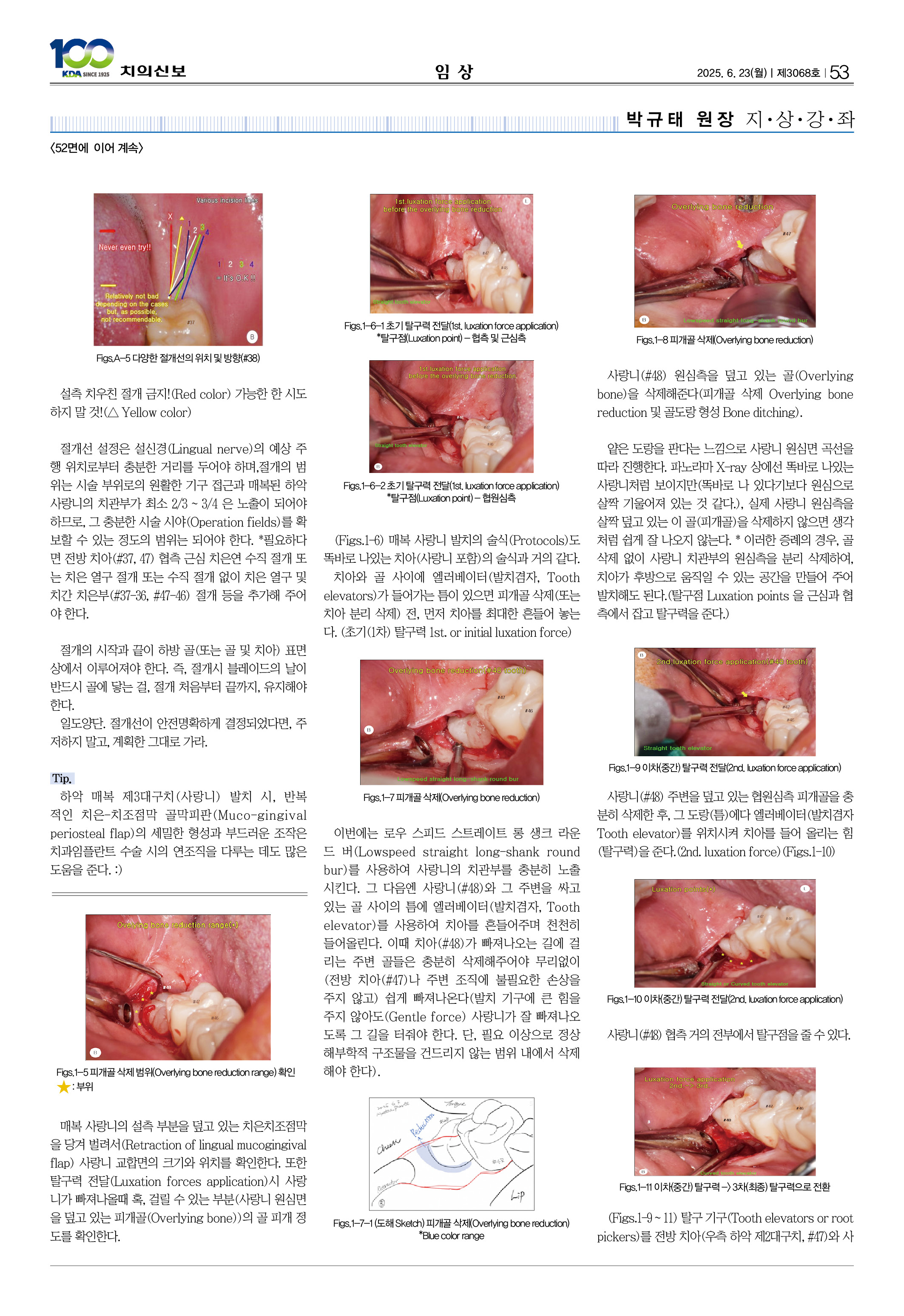 53_CG_0618_임상
