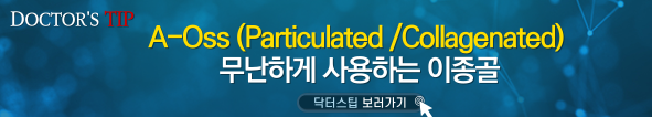 배너
