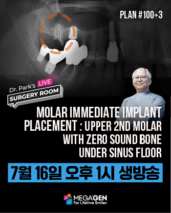 배너