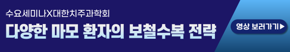 배너
