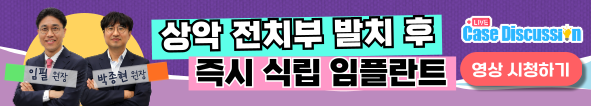 배너