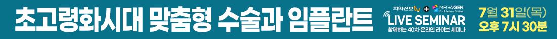 배너