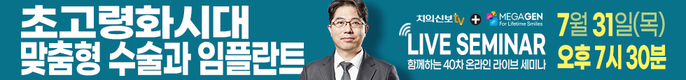 배너