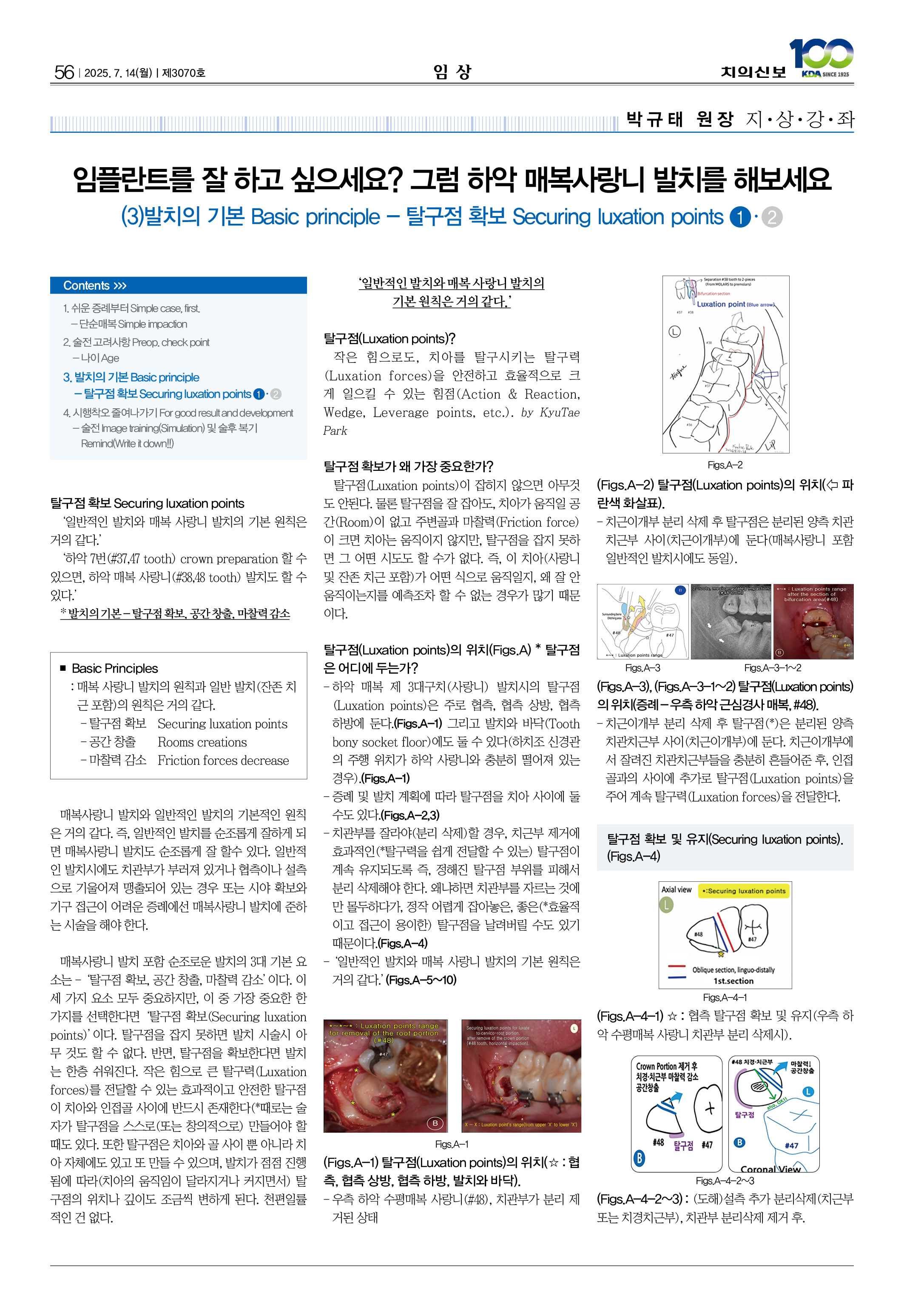 56_CG_0709_임상