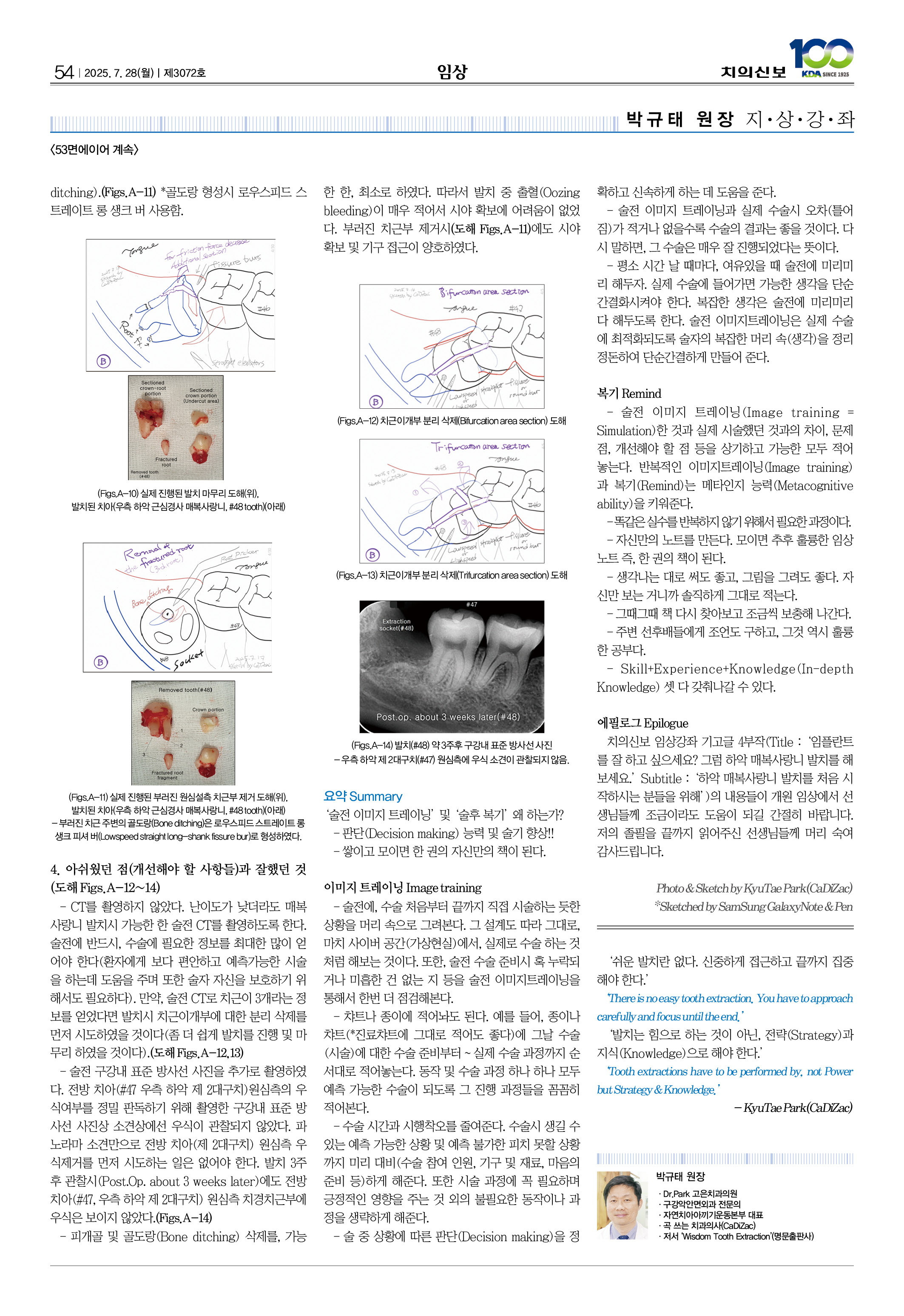 54_CG_0730_임상