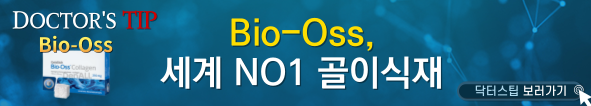 배너