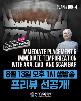 배너