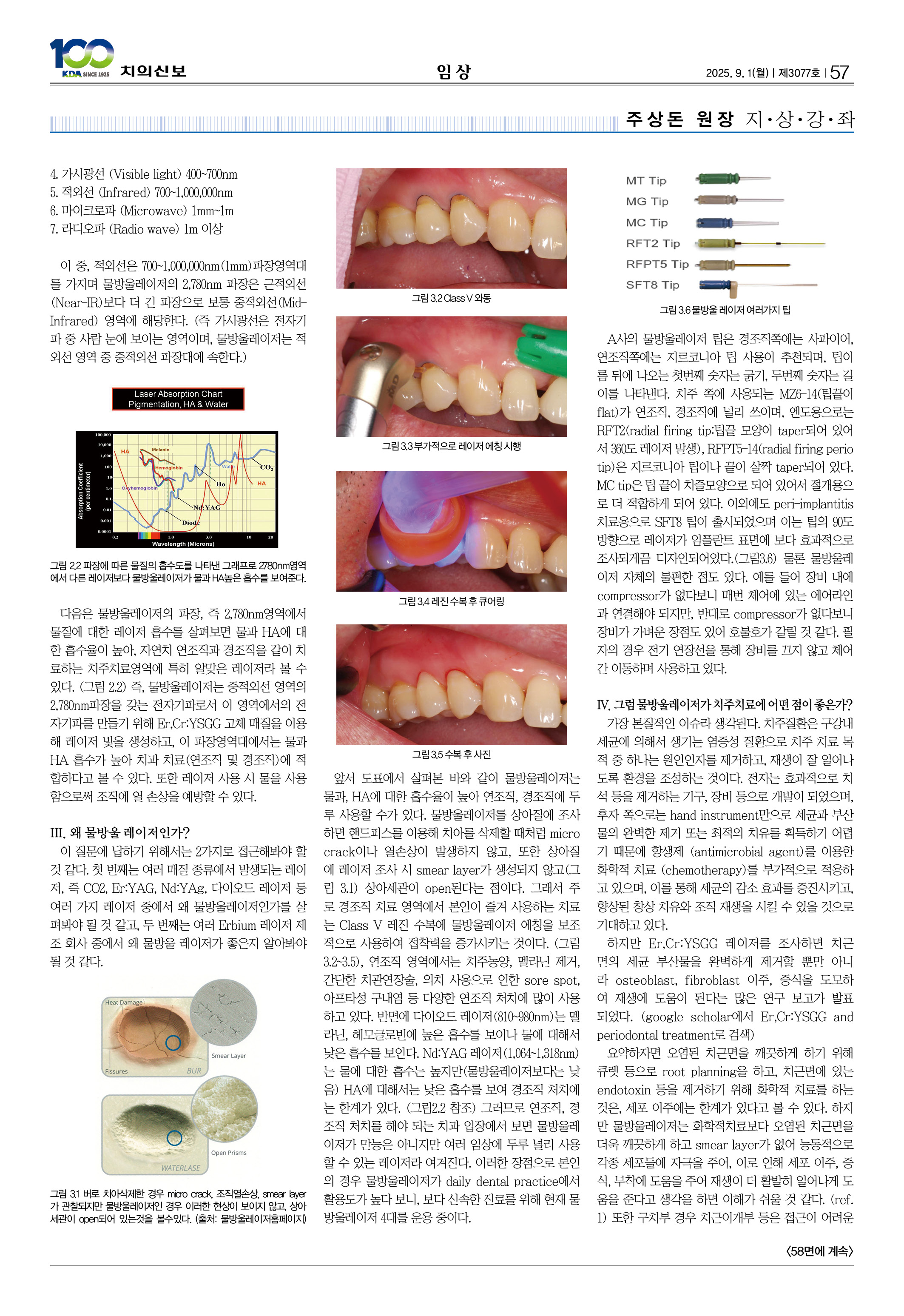 57_CG_0827_임상