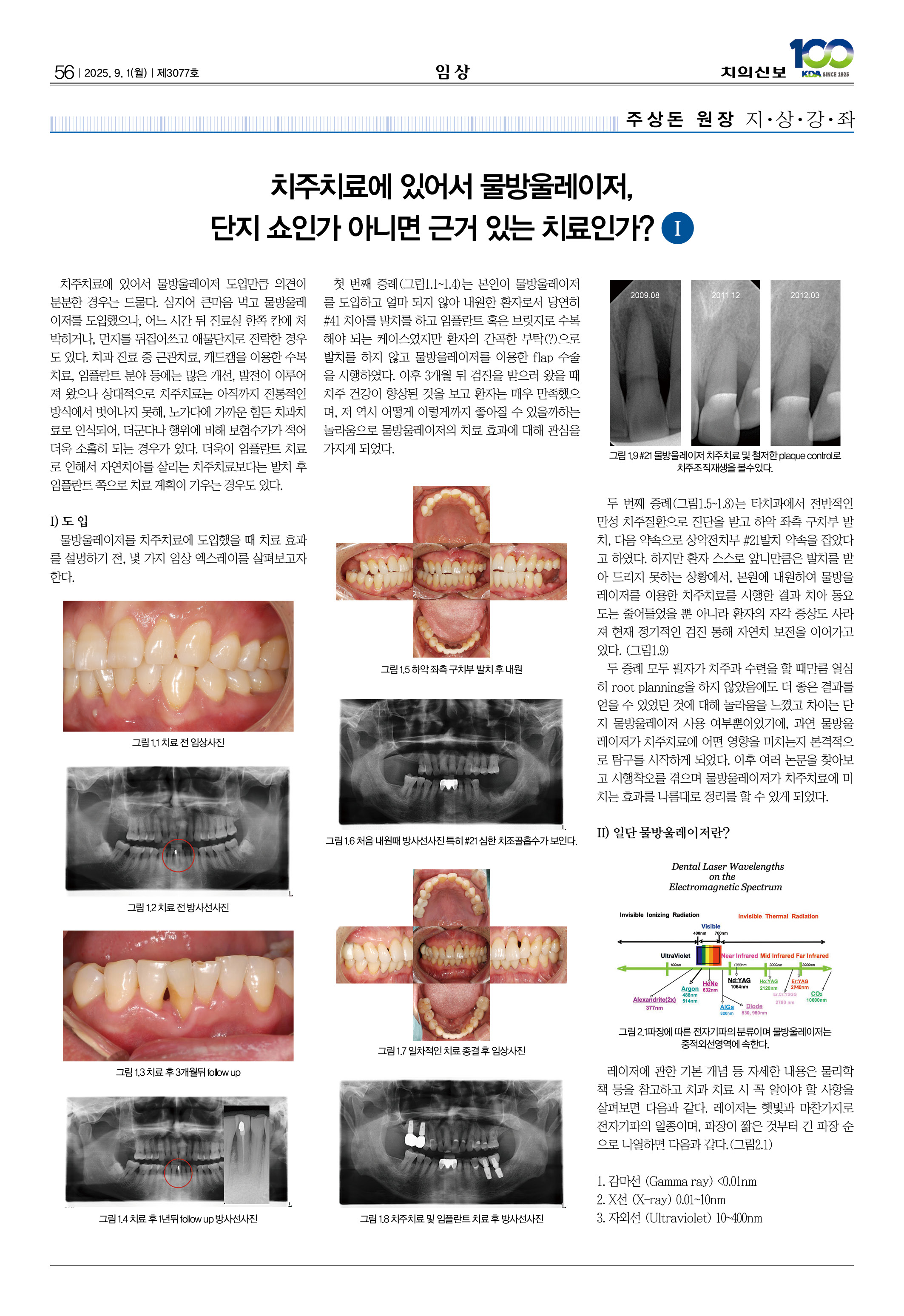 56_CG_0827_임상