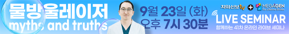 배너