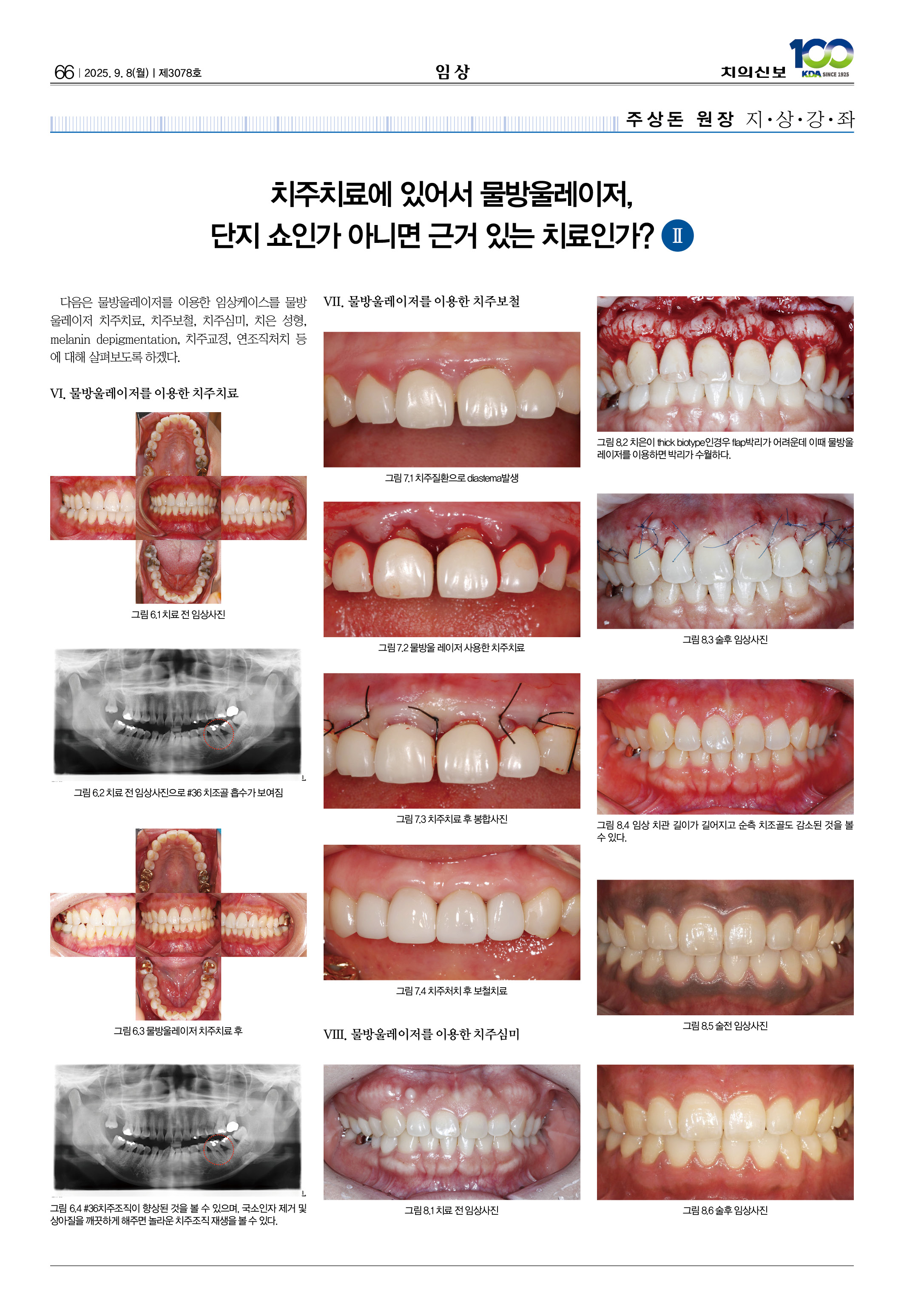 66_CG_0903_임상