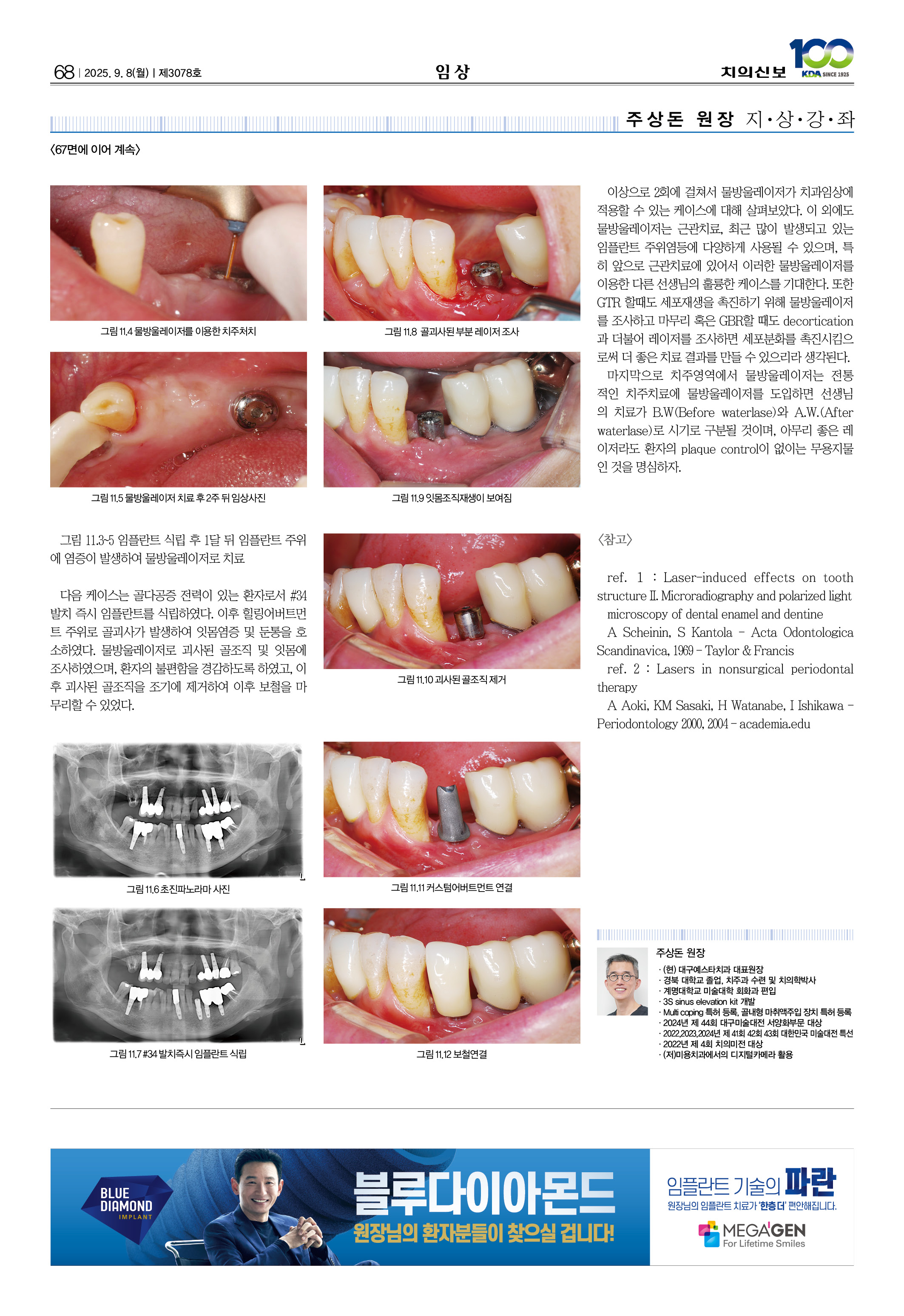 68_CG_0903_임상