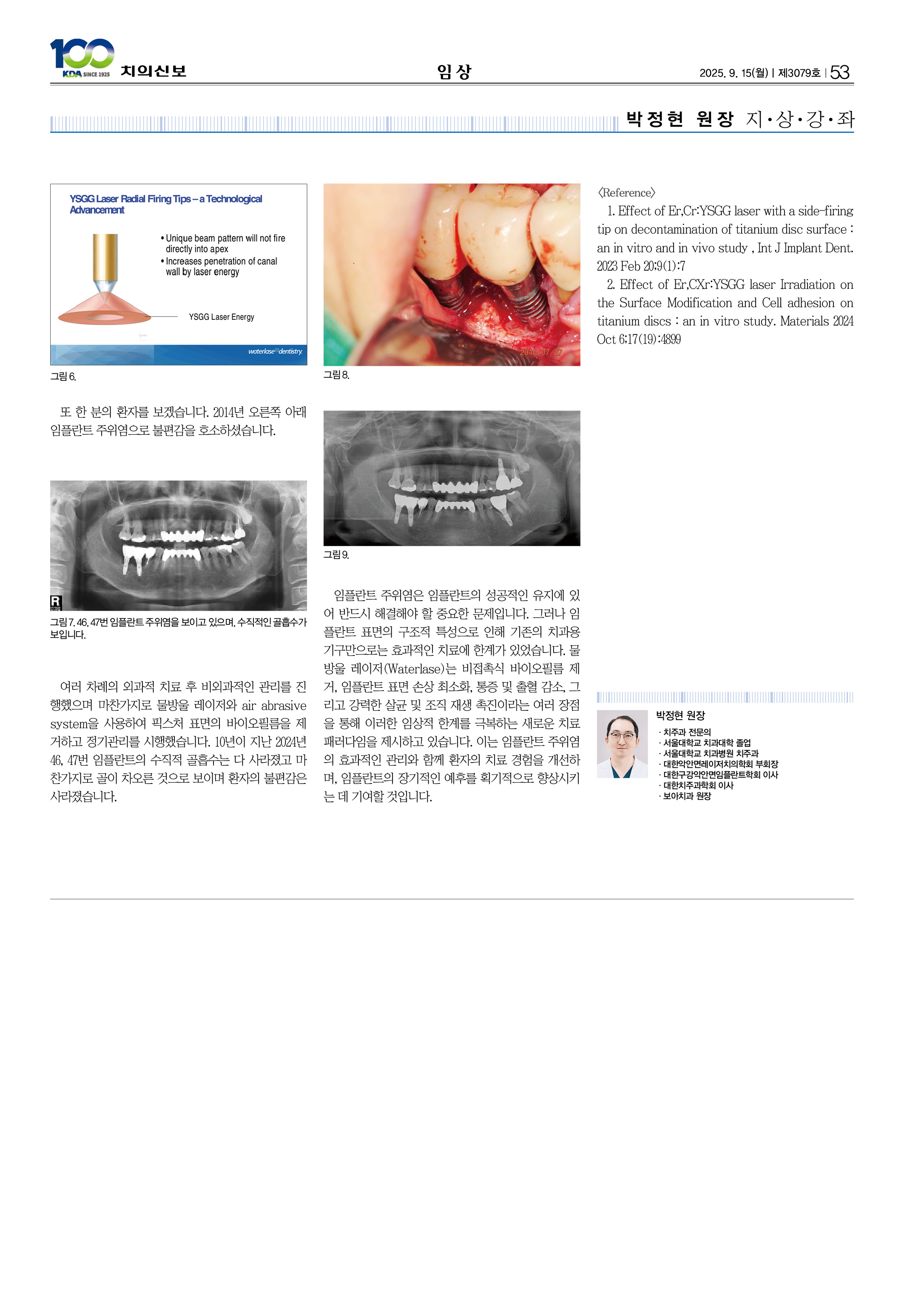53_CG_0910_임상