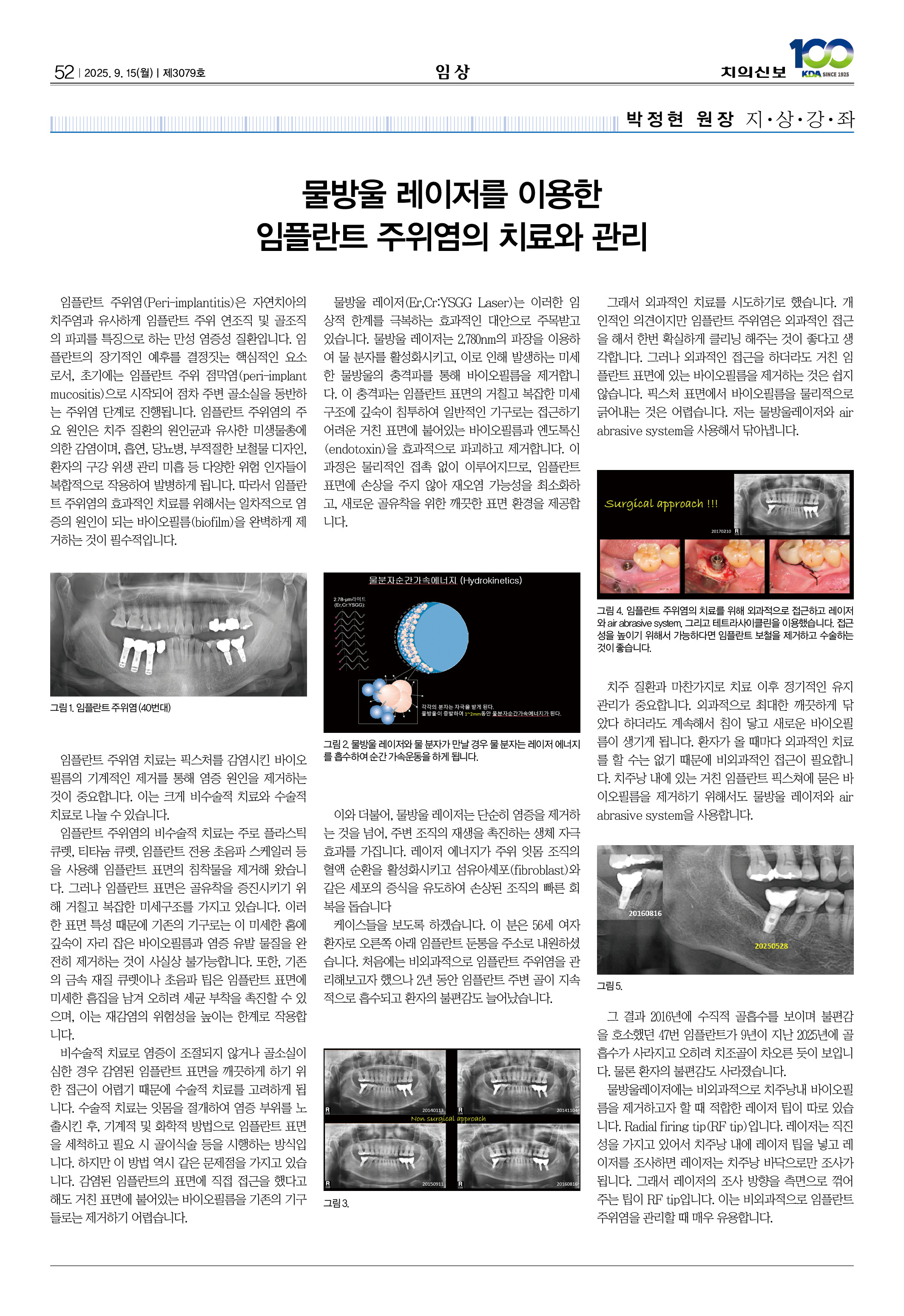 52_CG_0910_임상