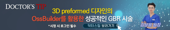 배너