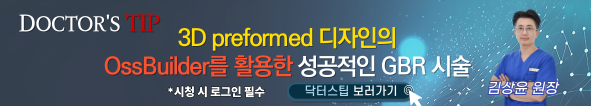 배너