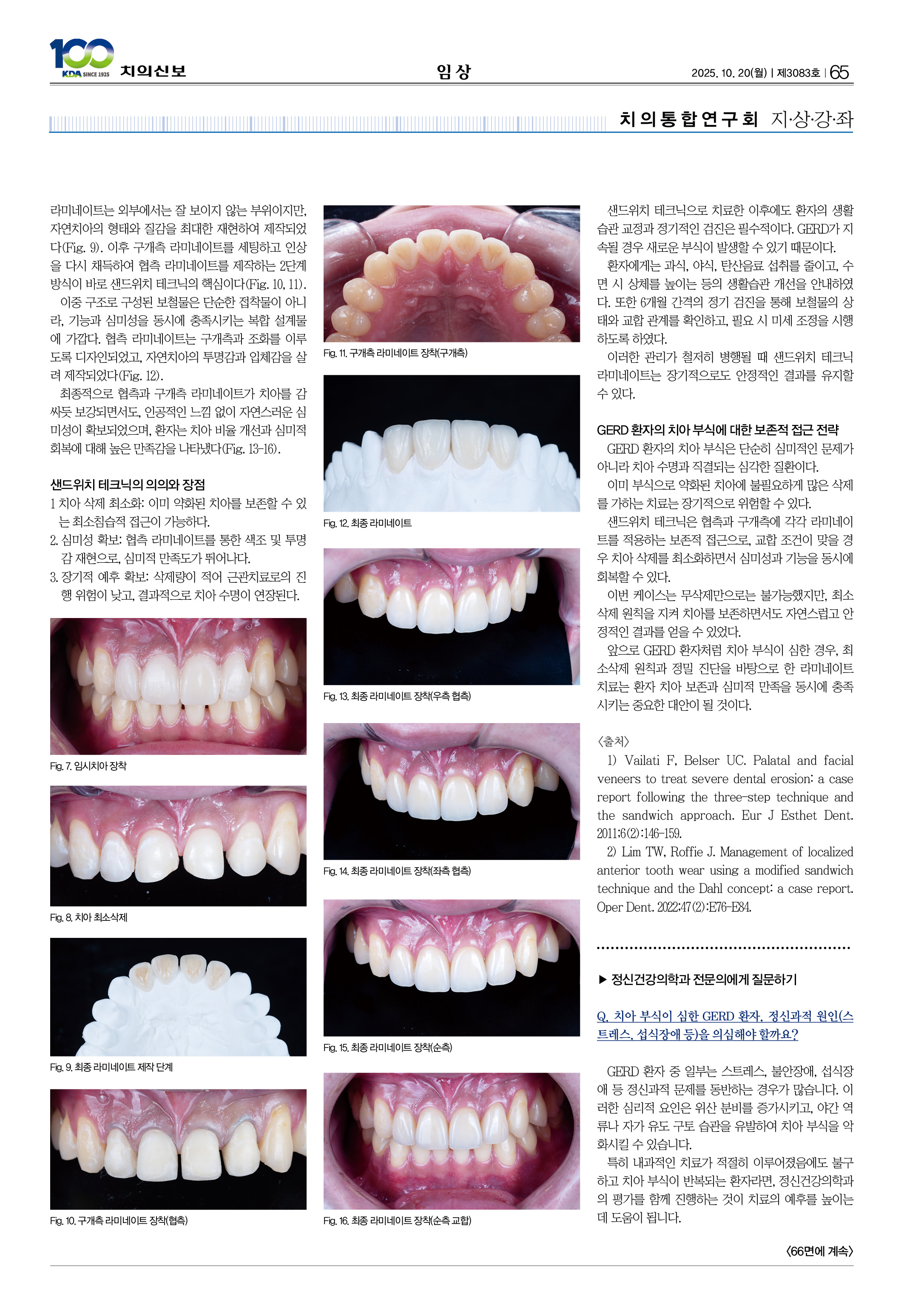 65_CG_1015_임상