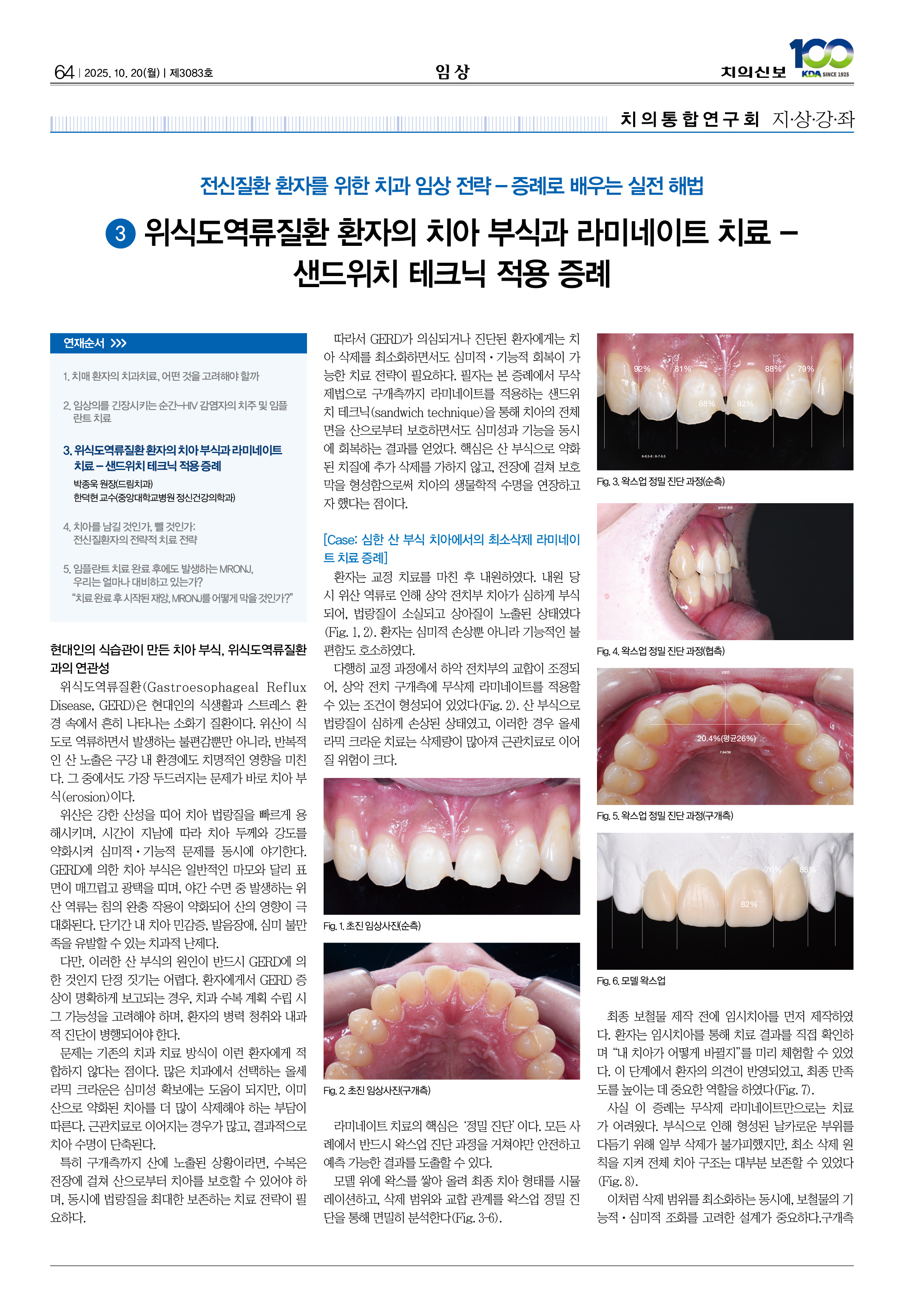64_CG_1015_임상