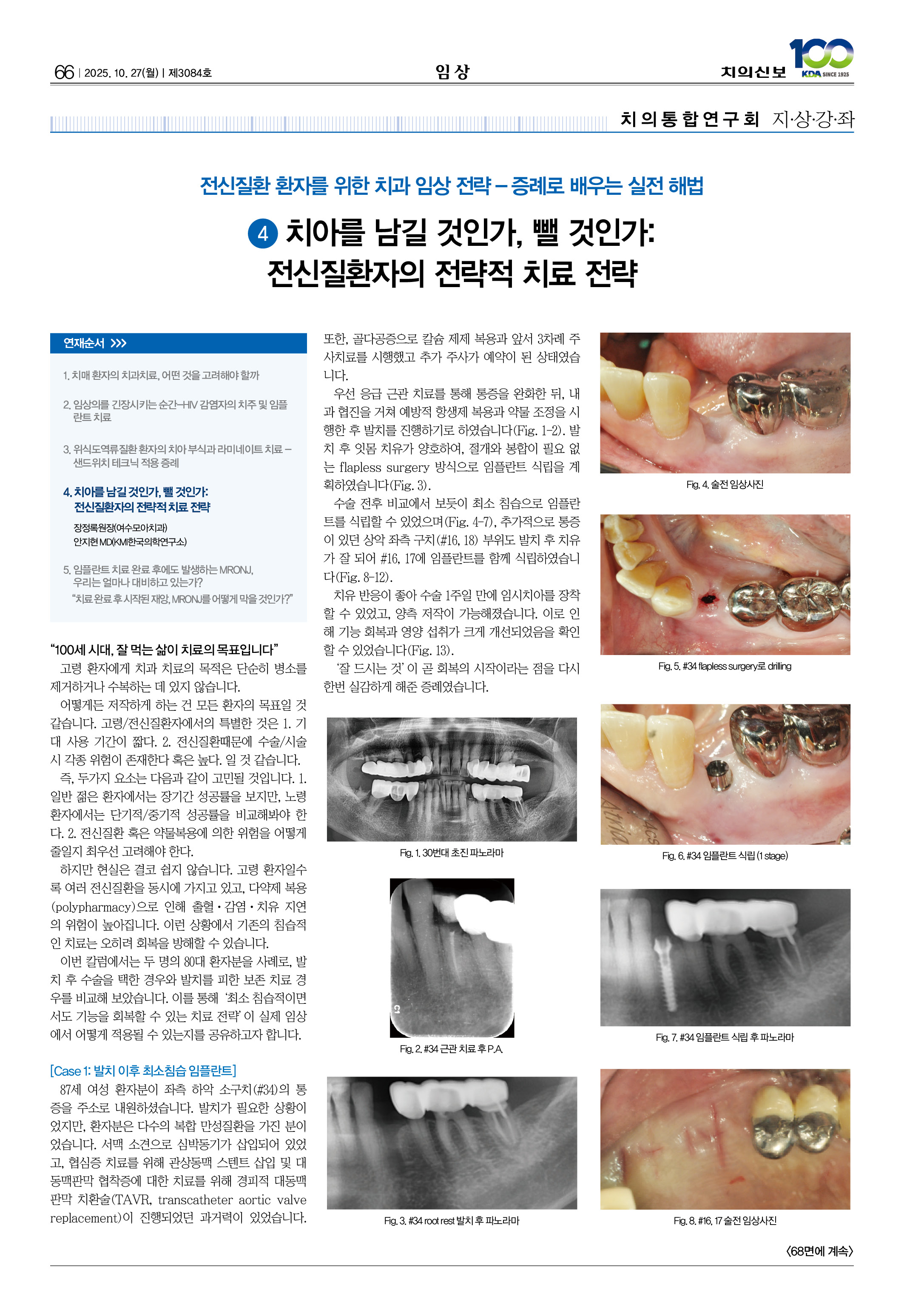 60_CG_1022_임상