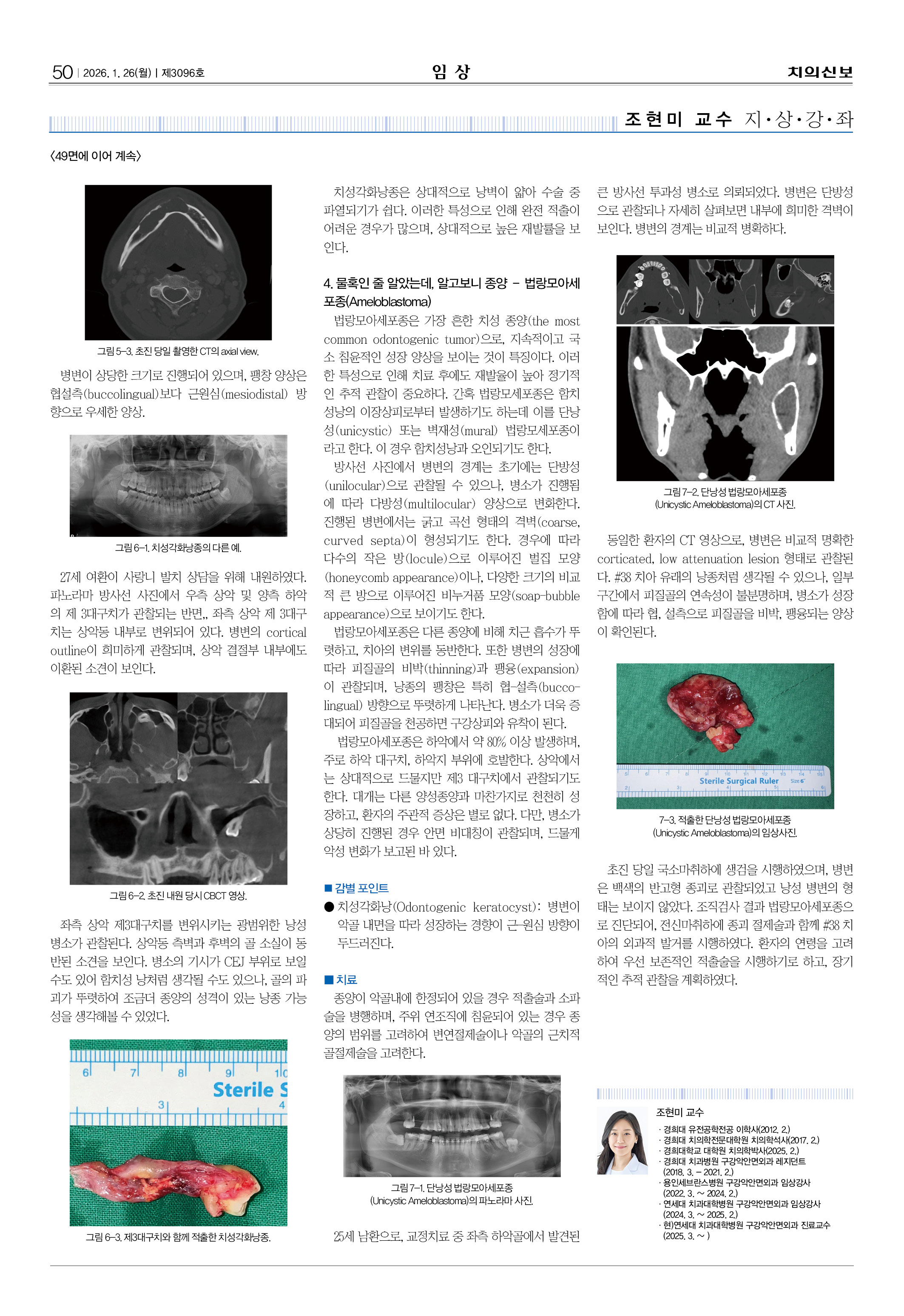 50_다시_CG_0121_임상
