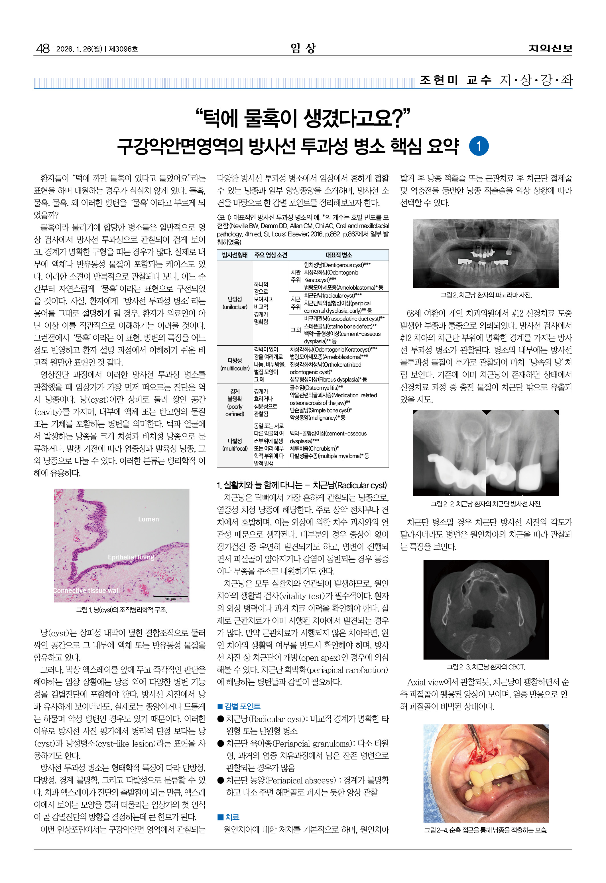 48_다시_CG_0121_임상