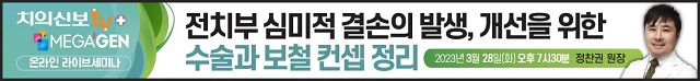 배너