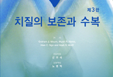 치아 수복 치료 최신 지견 여기에