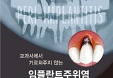 “골칫거리 임플란트주위염 해결 필독서”