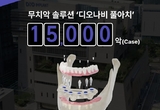 ‘디오나비 풀아치’ 누적 1만 5천악 돌파