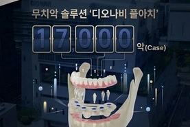 ‘디오나비 풀아치’ 누적 1만7000악 돌파