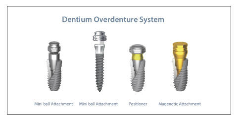 덴티움 'Full Attachment Line-up' 덴티움 'Full Attachment Line-Up'