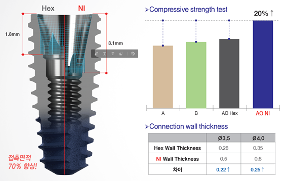 메가젠임플란트가 호환성과 강도가 향상된 Anyone NI 임플란트를 출시했다고 밝혔다.&lt;메가젠 제공&gt;