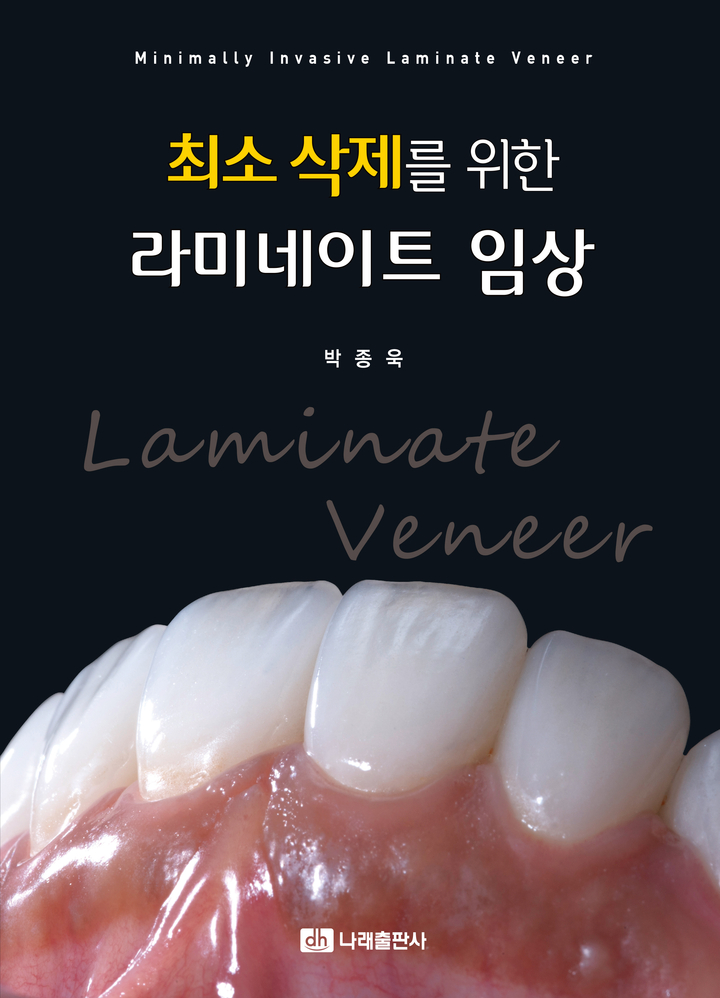 "최소 삭제 최대 심미" 라미네이트 진단 제시